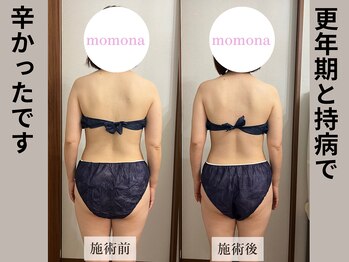 モモナ(Momona)/#肩こり#リンパマッサージ#野並