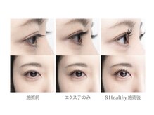 まつげパーマ・まつエク・アイブロウZenith Eye岡山表町店【ゼニス　アイ】/