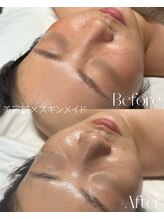 ルミア(LUMiA)/赤みが消え、水光肌に♪