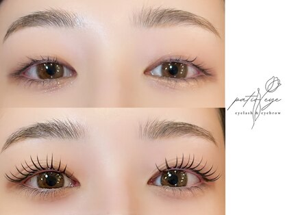 パティオアイ(Patio Eye)の写真