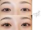 パティオアイ(Patio Eye)の写真