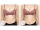 ミモア ローズ(Mimore Roze)の写真/<気になるお肉を徹底アプローチ>ドレスも綺麗に着こなせるスッキリとしたバスト・ラインへ♪