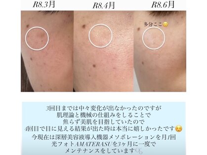シュアロ(shualo)の写真