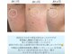 シュアロ(shualo)の写真