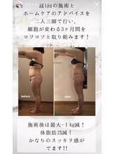 フローラ 自由が丘(Flora)/オーダーメイド痩身