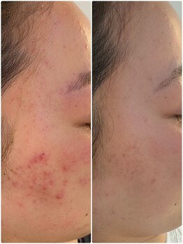 美顔研究所 バイ ヴィヴセカンド(美顔研究所 by viv 2nd)/