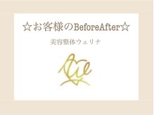 美容整体ウェリナ あま甚目寺院/7.【ダイエットbefore→after】