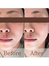 凪眠/小顔リンパフェイシャルの効果67