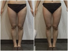 美容整体ウェリナ 名駅院/小顔矯正/骨盤矯正/美脚サロン