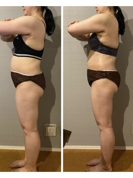 ぐりーんりぷる/全身フォースカッター1回