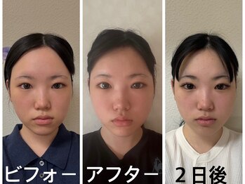 アクアナチュラ(ACQUANATURA)/目が大きくなりました!!