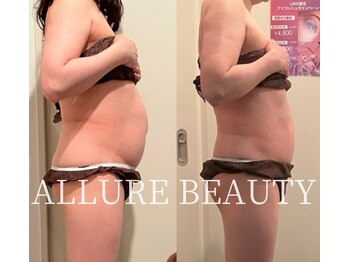 アリュールビューティー 下高井戸店(ALLURE BEAUTY)/60分3回モニター様