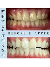 ドルチェ 水戸店(Dolce)/★ before → after ★