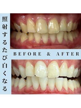 ドルチェ 水戸店(Dolce)/★ before → after ★