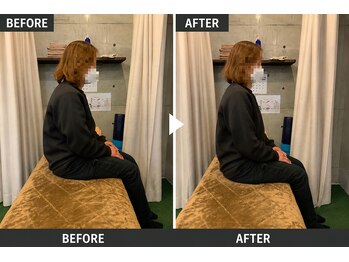 リセット整骨院しぎの院/BeforeAfter