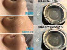 スムース(Smoooth)の雰囲気（ずっと気になっていた毛穴のお悩み一緒に改善していきましょう☆）