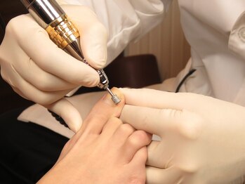 ポルクス鍼灸整骨院 表参道(Pollux鍼灸整骨院)/巻き爪補正