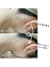 ユーサロン(U-Salon)/女性専用・完全個室【部分脱毛