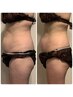 【お腹や二の腕太ももなど２箇所】2箇所40分6600円→5500円※女性限定