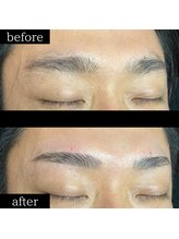 ユー 千葉駅前店(you)/症例写真