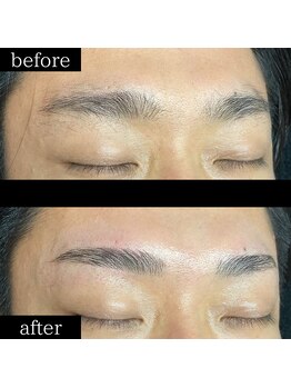 ユー 千葉駅前店(you)/症例写真