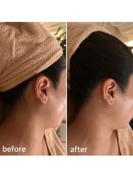 アルテ(ART-e)/襟足美人シェービン/ブライダル