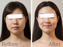 サロンドアクオン(salon de aqon)