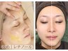 【再来(1ヶ月以内)】ハリ艶肌|レチノール導入ピーリング¥11,000→¥9,350