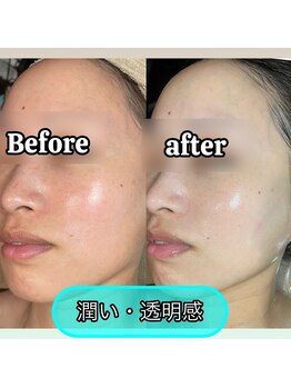 インチャント 四万十店(enchant)/肌に必要な栄養を見極め導入