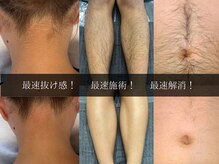 ノノケケ(NONOKEKE)の雰囲気（【メンズ＆レディース脱毛】ツルツル派or減毛派！肌質改善脱毛♪）