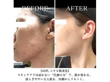 ヨサパーク ニコナ 三軒茶屋南口(YOSA PARK nicona)の写真