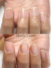 マリーロール 梅田店(Marie Laure)/自爪育成/深爪矯正/ネイルケア