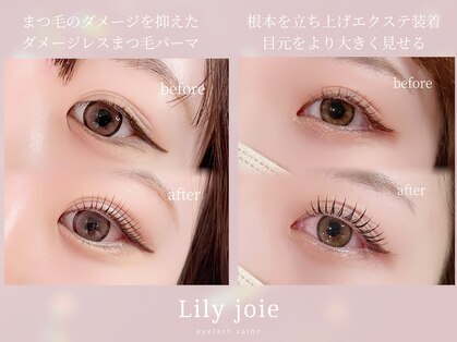 リリージョワ(Lily joie)の写真