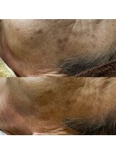 ギャラクシービューティー(galaxy beauty)/