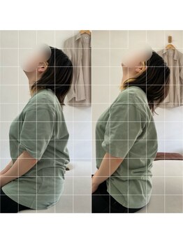 ナオル整体 池袋院(NAORU整体)/上が向けるように!