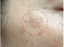 ラヴィアンローズ(La vie en Rose)/大きなシミケアもご相談下さい