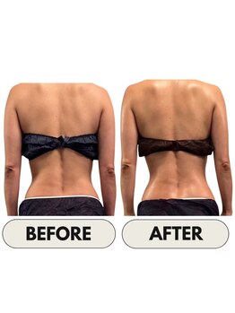 リーリア(LiLia)/Before・After♪