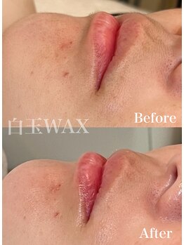 エレガ(ELEGA)/フェイシャルWAX