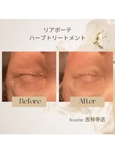 スリール 吉祥寺店(Sourire)/リアボーテハーブトリートメント