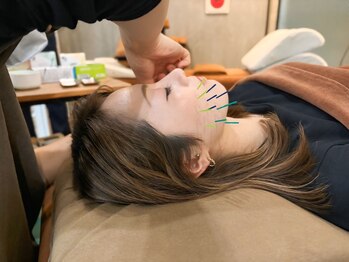 アラキ(ARAKI)/東成区美容鍼【リフトアップ】