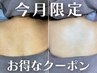 【8月限定】ツルスベ美背中｜肌育ハーブピーリング ¥11,000
