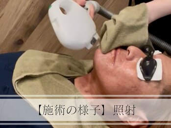 メンズプラス(MEN’S PLUS)/ヒゲ脱毛/施術風景