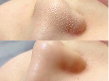 アンドアルファ 水戸(&α)&α/美眉/眉毛/アイブロウ/眉/水戸