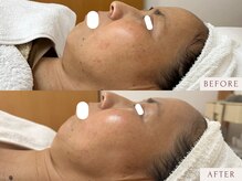 クラームビューティー(Clerm beauty)/【40代 女性】幹細胞プログラム