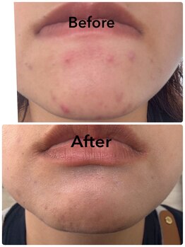 ゆるる(You*ruru)/