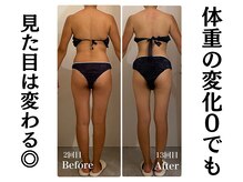 サンティエールの雰囲気（リンパマッサージで【背中スッキリ】元整体師のセラピストです◎）