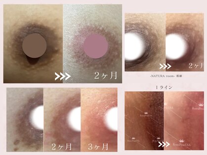 ナチュラルーム 那覇(NATURA room)の写真