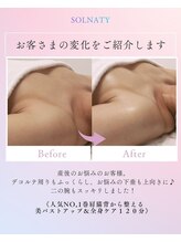 ソルナティ 伊勢原(SOLNATY)/産後のお悩みに◎