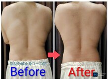 坂井整体院の雰囲気（脂肪分解酵素ジェルを使用してすぐに実感できるスッキリボディへ）