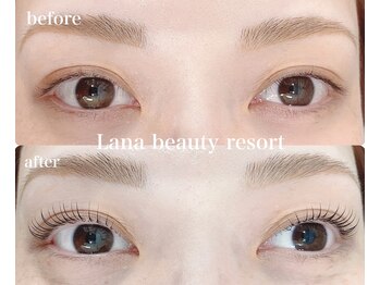 ラナビューティリゾート(Lana Beauty resort)/アップラッシュリフト